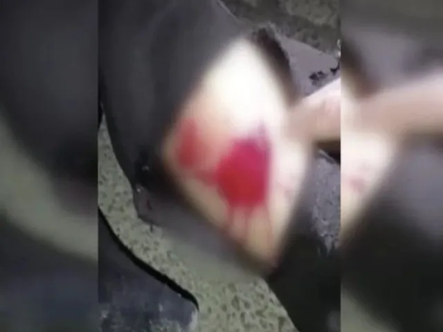 Esenyurt'ta Köpek Terörü! Adam Sokakta Canından Oluyordu